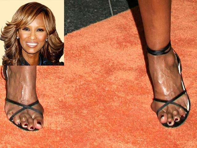 15 of the Ugliest Celebrity Feet.